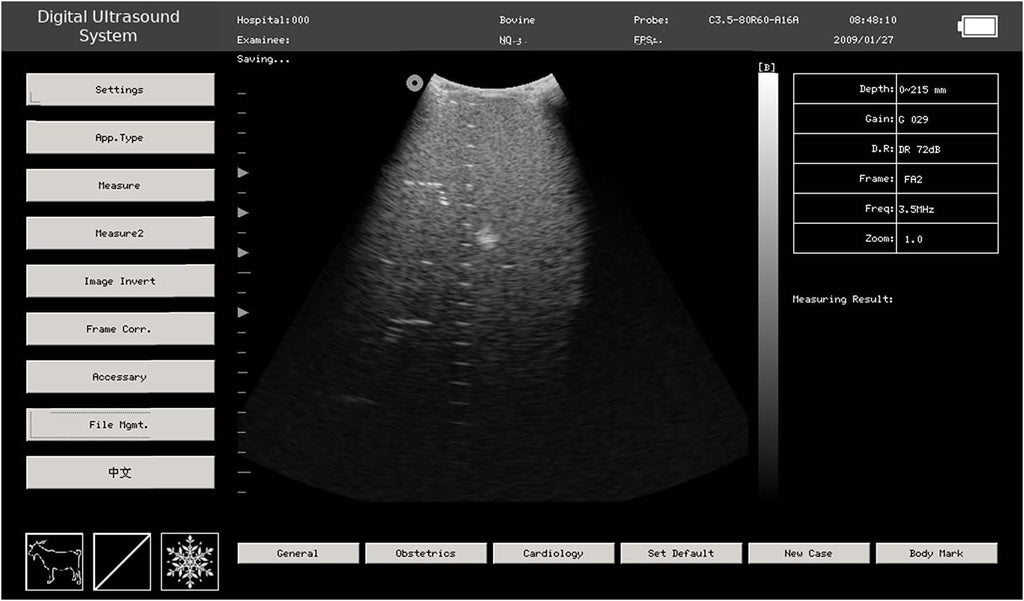 Veterinary Ultrasound Scanner with Convex and Rectal Linear Probe V8838